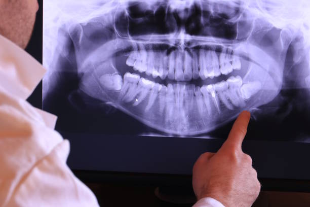 Best Emergency Root Canal Treatment in Chester, PA